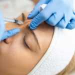Botox w Helsinkach – Precyzyjne Zabiegi pod Okiem Chirurga Ville Männistö