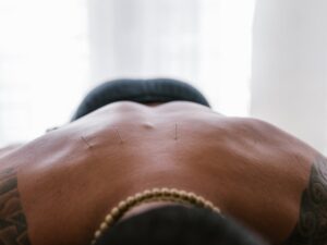 acupuncture clinic interior